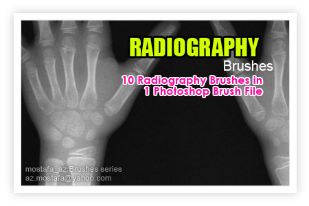 radiography.jpg